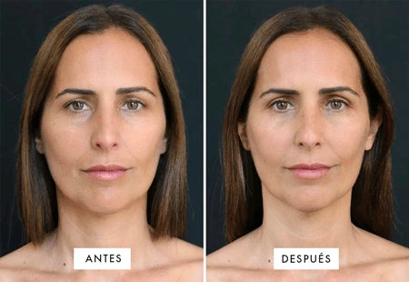 GlowLift® – Masajeador Facial Profesional