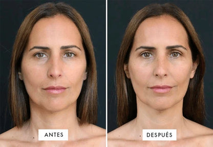 GlowLift® – Masajeador Facial Profesional